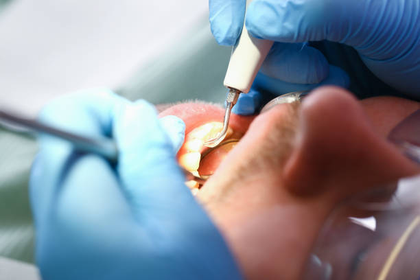 Best Weekend Emergency Dentist in Kernersville, NC
