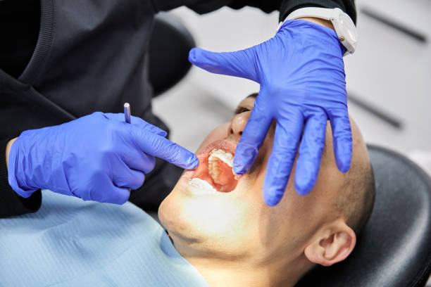 Best Emergency Wisdom Teeth Removal in Kernersville, NC