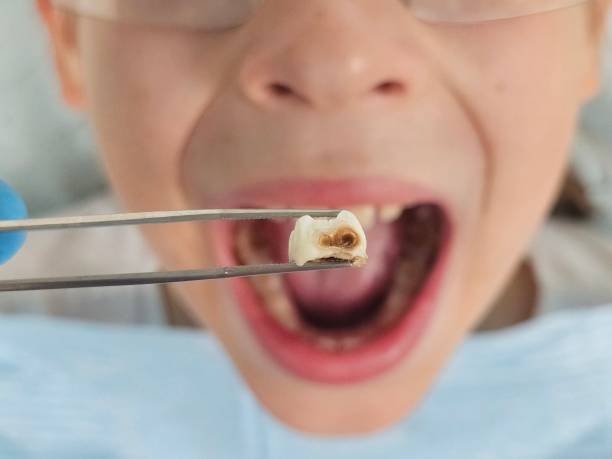 Best Emergency Broken Tooth Repair in Kernersville, NC